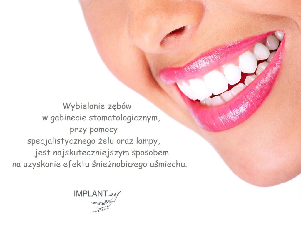 Wybielanie zębów, Implant-Art, Warszawa Mokotów- Wybielanie zębów w gabinecie stomatologicznym, przy pomocy specjalistycznego żelu oraz lampy, jest najskuteczniejszym sposobem na uzyskanie efektu śnieżnobiałego uśmiechu.