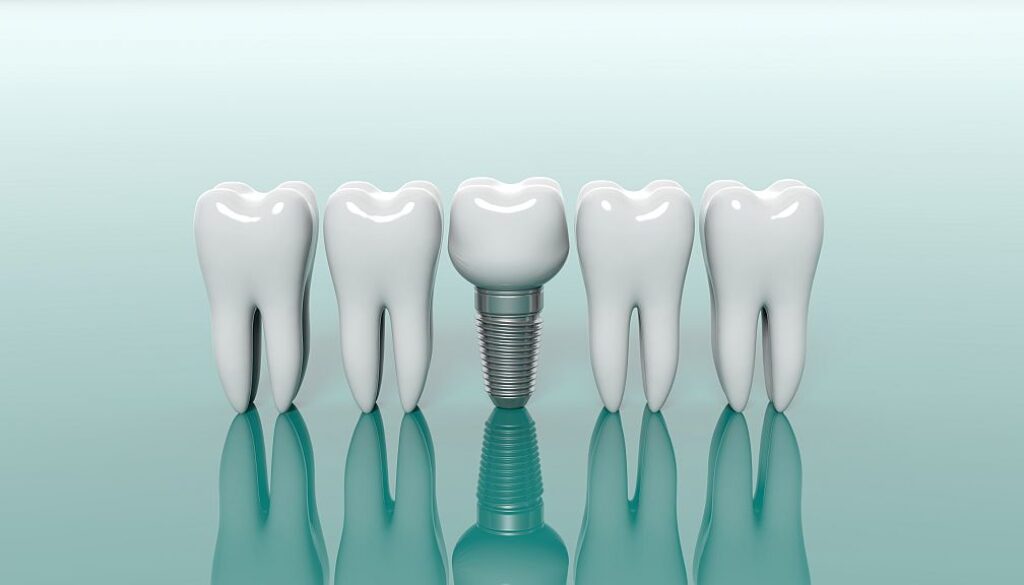 Ile można mieć implantów zębowych?
