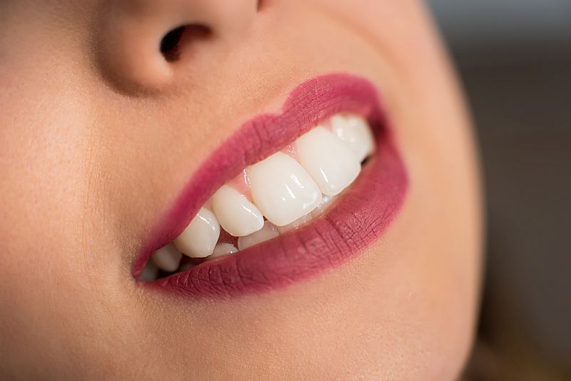 Close up of beautiful young smiling woman with perfect teeth in dental office