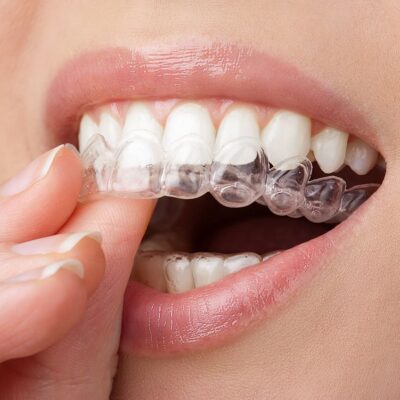 Ortodoncja Ortodoncja