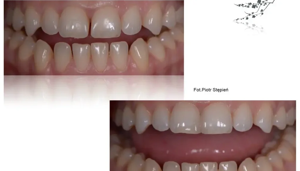 diastema_1-1024x768